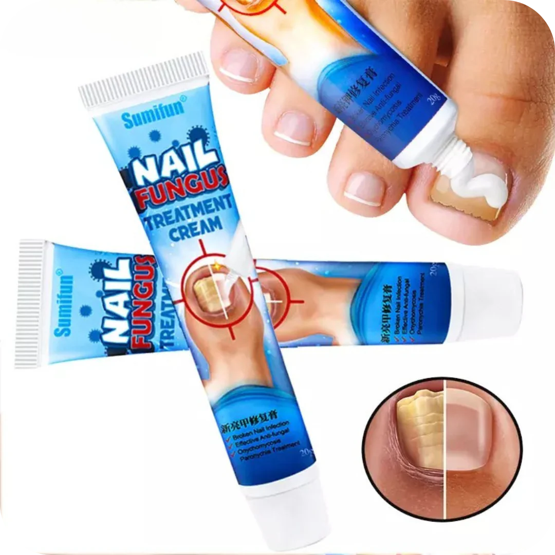 Crema Anti Hongos para los Pies | NailFungus®