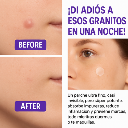 Parche para manchas negras y acne Pack de 144 unidades
