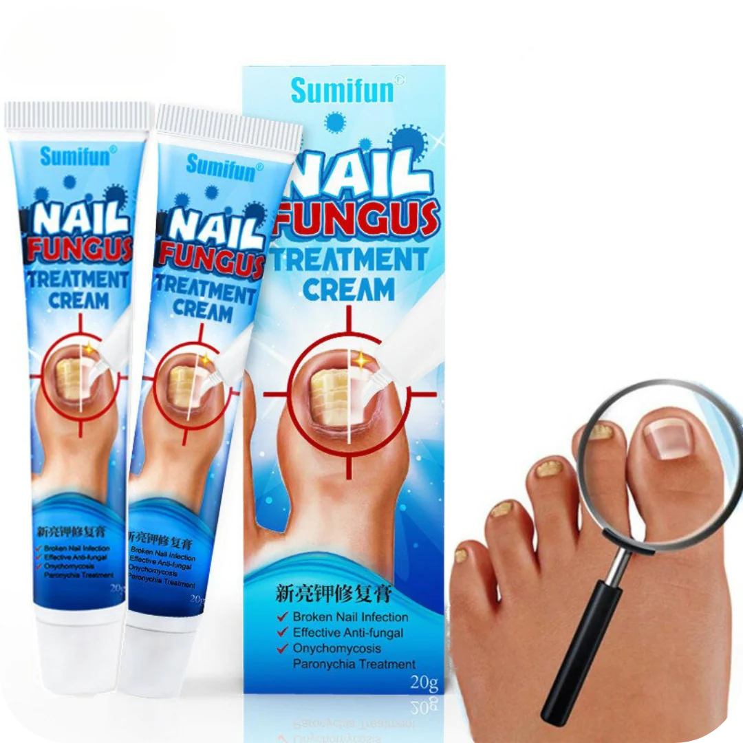 Crema Anti Hongos para los Pies | NailFungus®