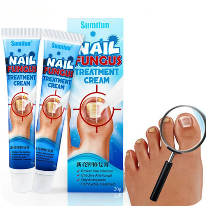 Crema Anti Hongos para los Pies | NailFungus®